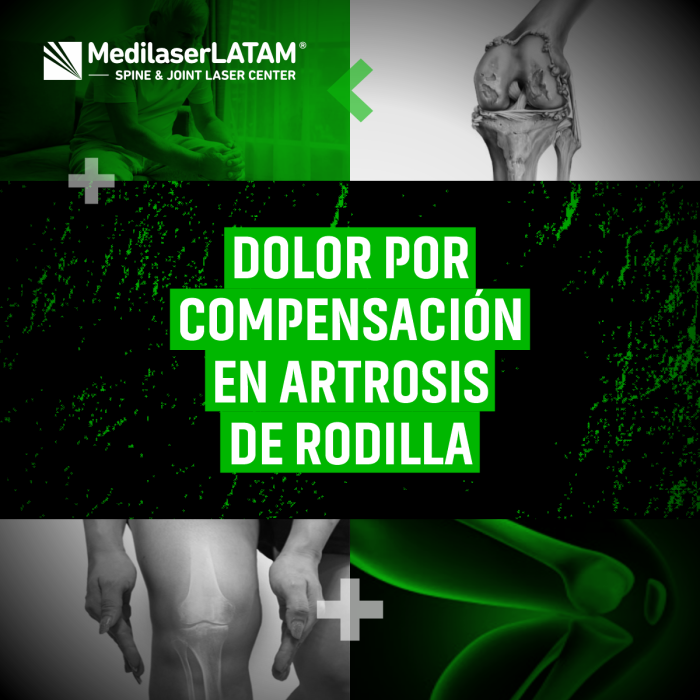 ¿Dolor en cadera o espalda por compensar artrosis de rodilla? Reequilibra tu postura con tratamientos personalizados.
