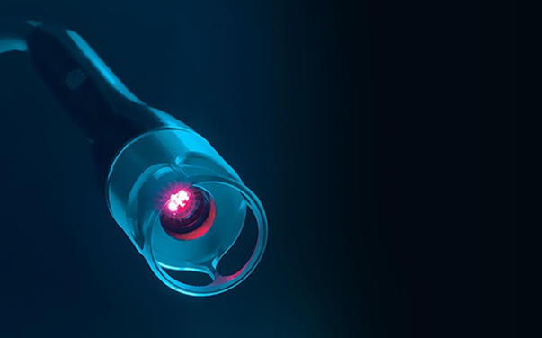 Procedimientos mínimamente invasivos para hernias discales y artrosis. Sin hospitalización, sin riesgos. Recuperación rápida.