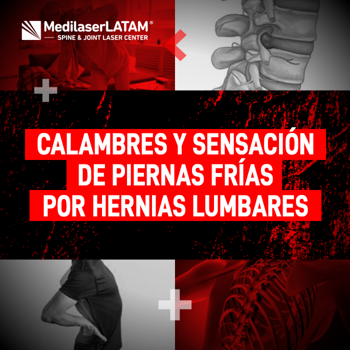 Piernas frías hernias: ¿Sabías que los calambres y la sensación de frío en las piernas pueden ser síntomas de hernias lumbares? Descubre por qué.