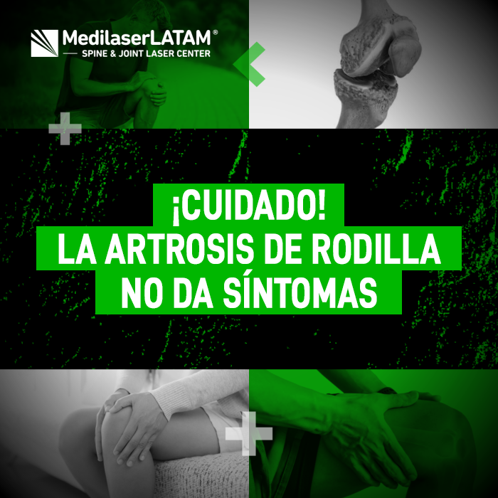 Artrosis rodilla asintomática: La artrosis avanza sin síntomas. Conoce cómo identificar signos tempranos y evitar la prótesis con cirugía láser.