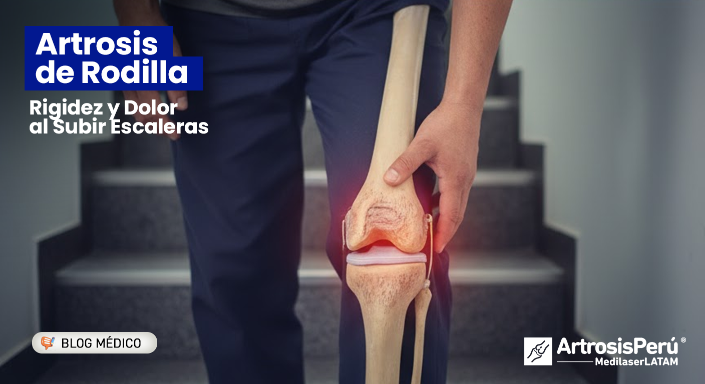 La Artrosis de Rodilla causa rigidez y dolor al subir escaleras. Conoce esta condición y la solución láser no invasiva que ofrecemos para tu bienestar.