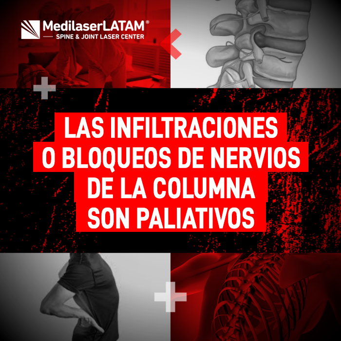 Adiós al adormecimiento de brazos y manos por hernias de cuello. Recupera el sueño y la movilidad con nuestra cirugía láser no invasiva en Perú.