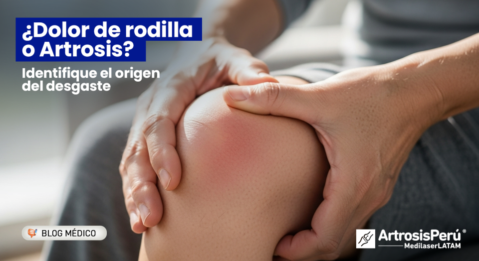 ¿Siente dolor al bajar escaleras? Identifique si es Artrosis de rodilla y conozca cómo evitar la prótesis con tecnología láser.
