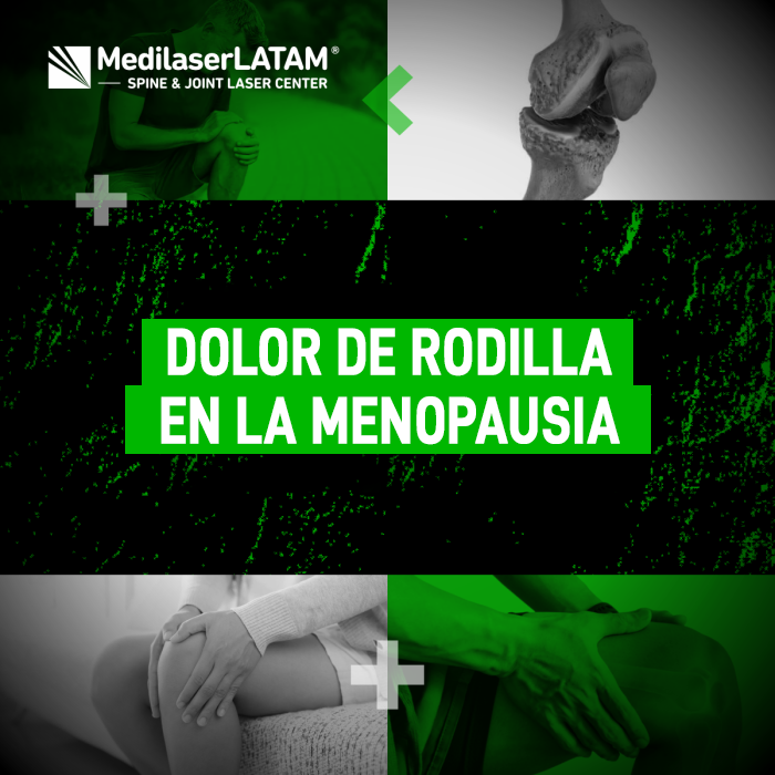 Dolor de rodilla en la menopausia: conoce por qué ocurre este síntoma y cómo el tratamiento láser ayuda a fortalecer la articulación.