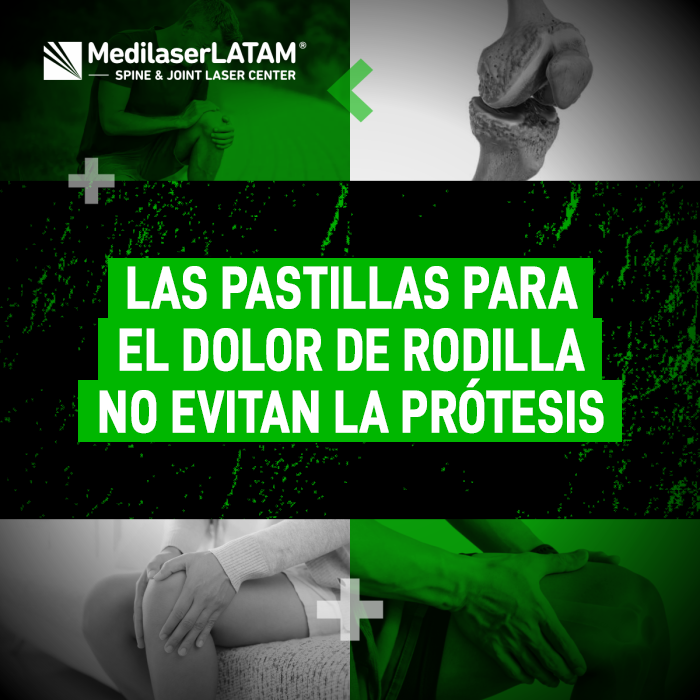 Las pastillas para el dolor de rodilla no evitan la prótesis. Entiende por qué solo enmascaran el síntoma y cómo evitar la cirugía con láser médico.