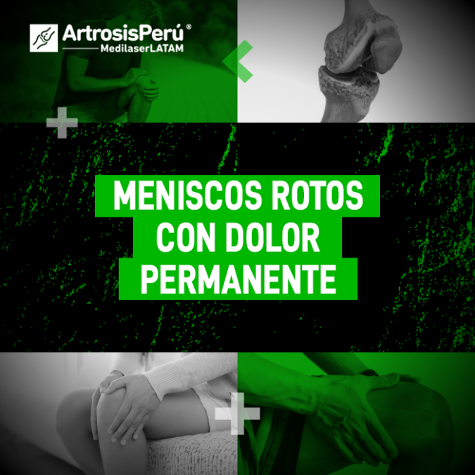 Descubre cómo tratar los Meniscos rotos y el dolor permanente con tecnología láser. Información clave para recuperar la movilidad sin cortes.