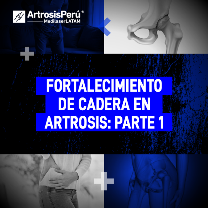 Guía de ejercicios para el fortalecimiento de cadera en casos de artrosis. Mejora tu movilidad y protege la articulación con estos consejos médicos.