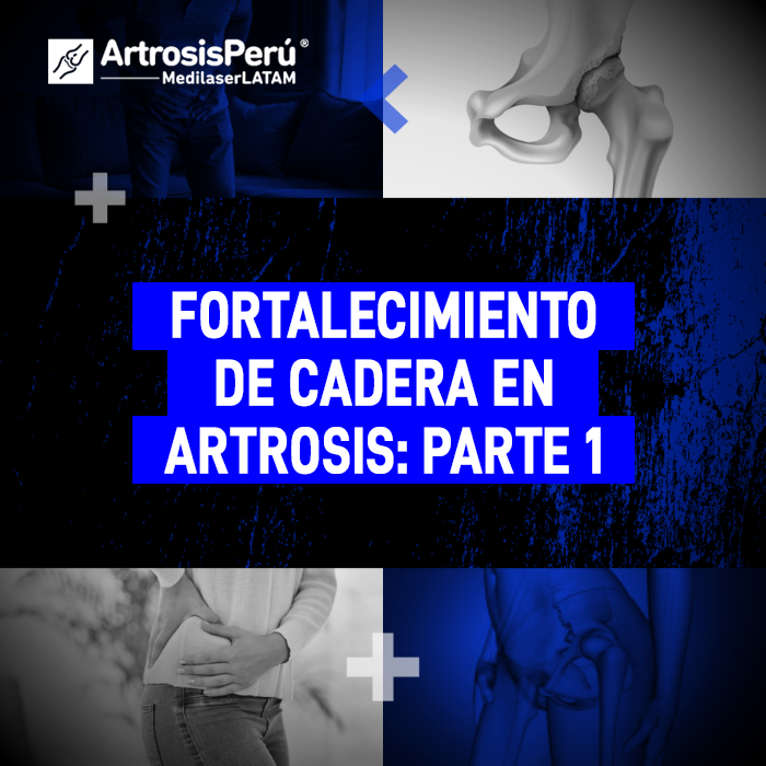 Guía de ejercicios para el fortalecimiento de cadera en casos de artrosis. Mejora tu movilidad y protege la articulación con estos consejos médicos.
