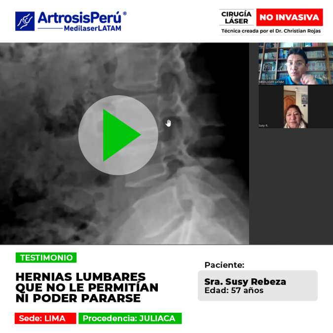 Testimonio de recuperación de Hernias lumbares severas. Paciente vuelve a caminar y ponerse de pie gracias a nuestra tecnología láser avanzada.