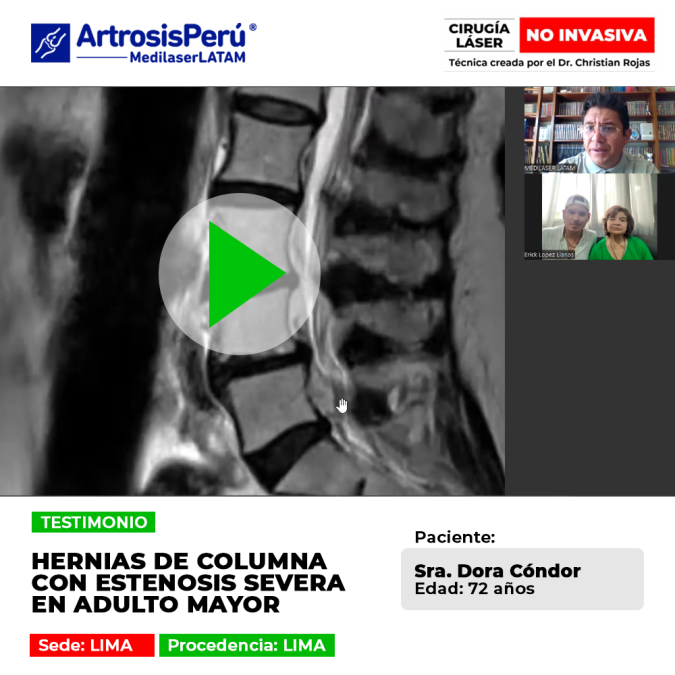 Adulto mayor supera la Estenosis de columna y Hernias con cirugía láser no invasiva. Recupera tu calidad de vida sin cortes ni riesgos.