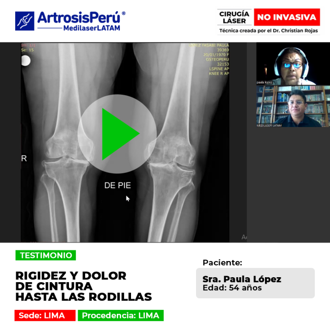 Paciente logra superar la rigidez y el dolor crónico que se extendía desde la cintura hasta las rodillas. Conoce su proceso de recuperación con láser.
