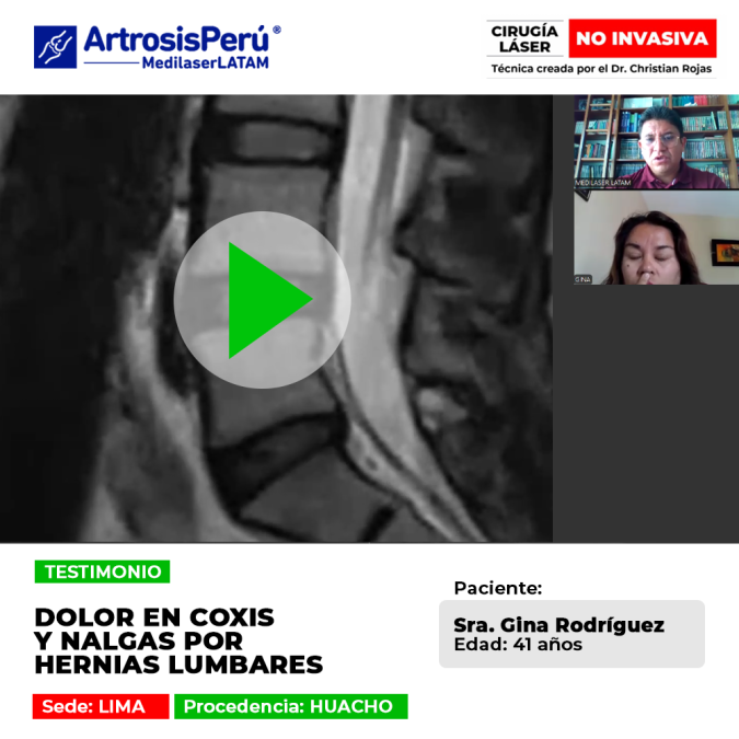 Testimonio sobre la eliminación del dolor en coxis y zona glútea causado por hernias lumbares. Descubre cómo el tratamiento láser evitó la cirugía.