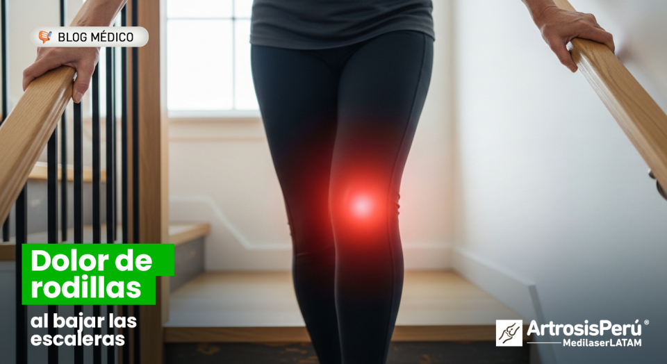 Si sufres de dolor de rodilla al bajar escaleras, podrías tener un desgaste en la rótula. Descubre cómo evitar que la Artrosis progrese.