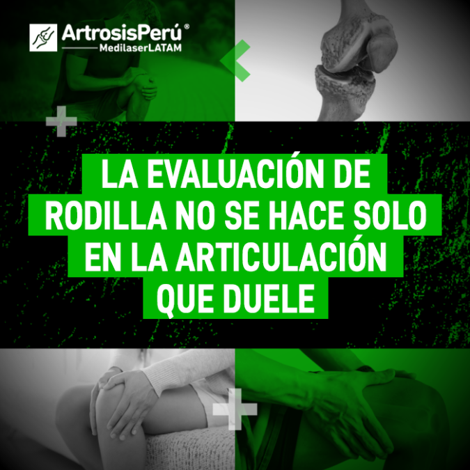 Evaluación de rodilla: descubre por qué el origen del dolor puede estar fuera de la articulación y cómo realizar un diagnóstico preciso.