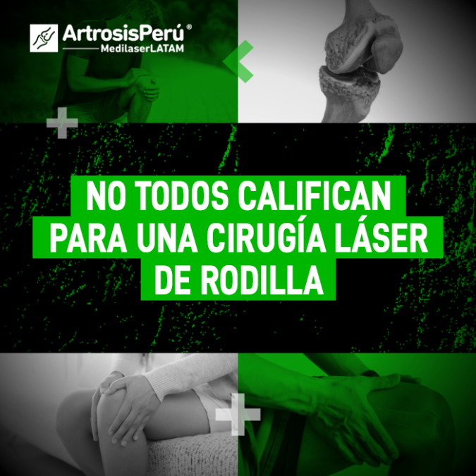 Cirugía láser de rodilla: conoce los criterios médicos indispensables para saber si eres apto para este procedimiento avanzado sin cortes.