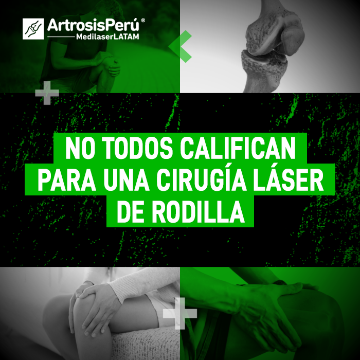 Cirugía láser de rodilla: conoce los criterios médicos indispensables para saber si eres apto para este procedimiento avanzado sin cortes.