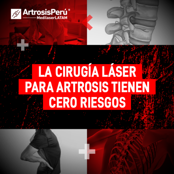 Cirugía láser para Artrosis: descubre por qué este procedimiento de alta precisión ofrece máxima seguridad y cero riesgos para el paciente.