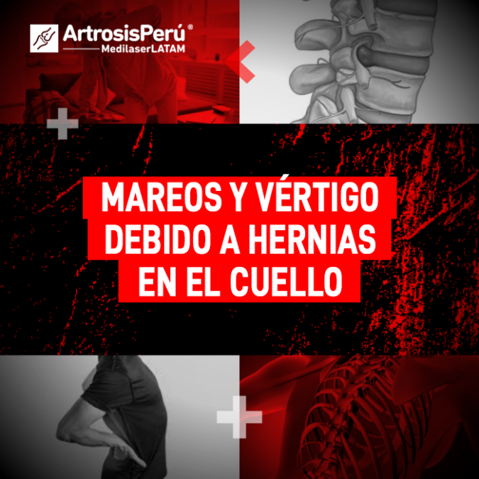 Hernias en el cuello: descubre la relación entre el desgaste cervical y los cuadros de mareos o vértigo que afectan tu equilibrio diario.
