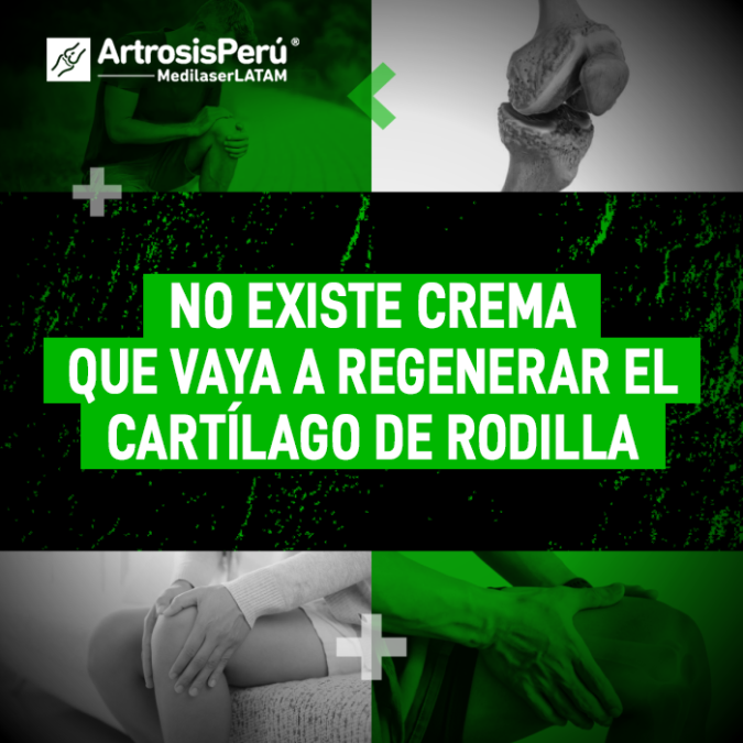 Cartílago de rodilla: la verdad sobre las cremas milagrosas y por qué la tecnología láser es la única capaz de estimular la regeneración.