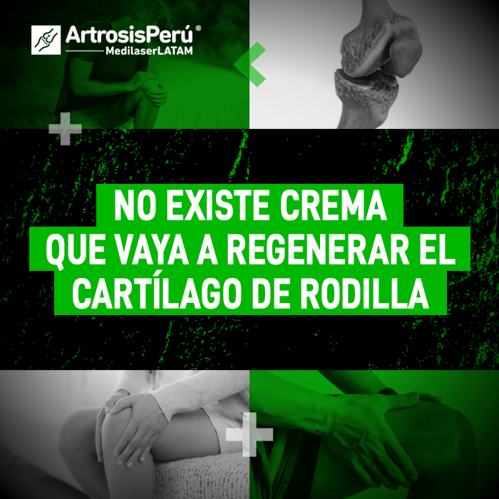 Cartílago de rodilla: la verdad sobre las cremas milagrosas y por qué la tecnología láser es la única capaz de estimular la regeneración.