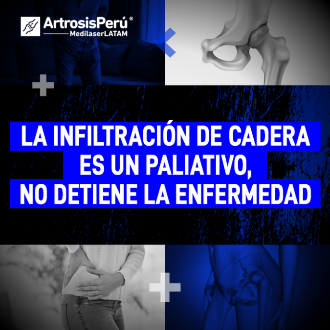 Infiltración de cadera es un paliativo. Descubre por qué este procedimiento no detiene la enfermedad con la explicación del Dr. Rojas.
