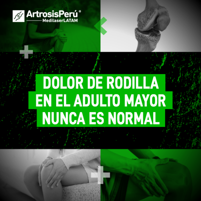 Dolor de rodilla en el adulto mayor: por qué no debe aceptarse como parte de la edad y cómo la cirugía láser detiene el desgaste.