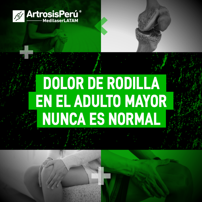 Dolor de rodilla en el adulto mayor: por qué no debe aceptarse como parte de la edad y cómo la cirugía láser detiene el desgaste.