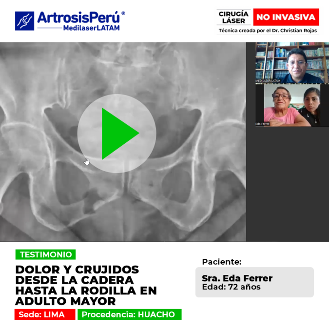 Sintomatología de dolor y crujidos articulares en miembros inferiores durante el adulto mayor y opciones de tratamiento médico especializado.