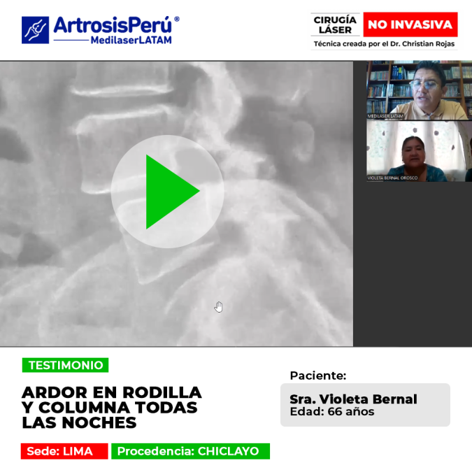 Ardor en rodilla y columna: cómo la tecnología láser de alta potencia elimina el dolor nocturno y restaura el descanso profundo.