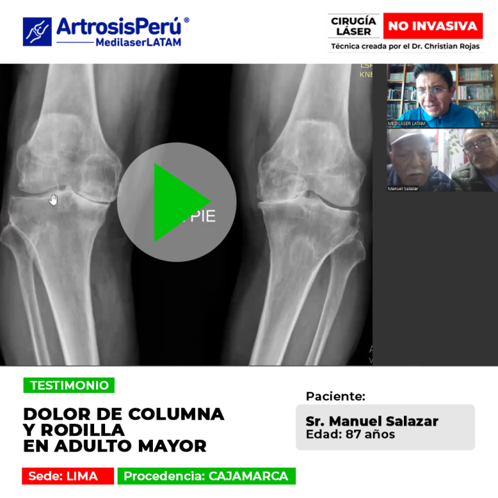 Dolor de columna y rodilla en el adulto mayor. Descubre la recuperación de este paciente con tecnología láser avanzada en nuestro blog.