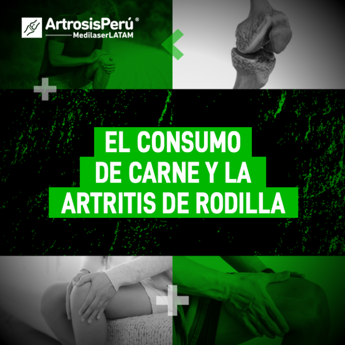 Artritis de rodilla y alimentación: cómo el consumo de carne influye en la inflamación articular y qué medidas tomar para proteger tu salud.