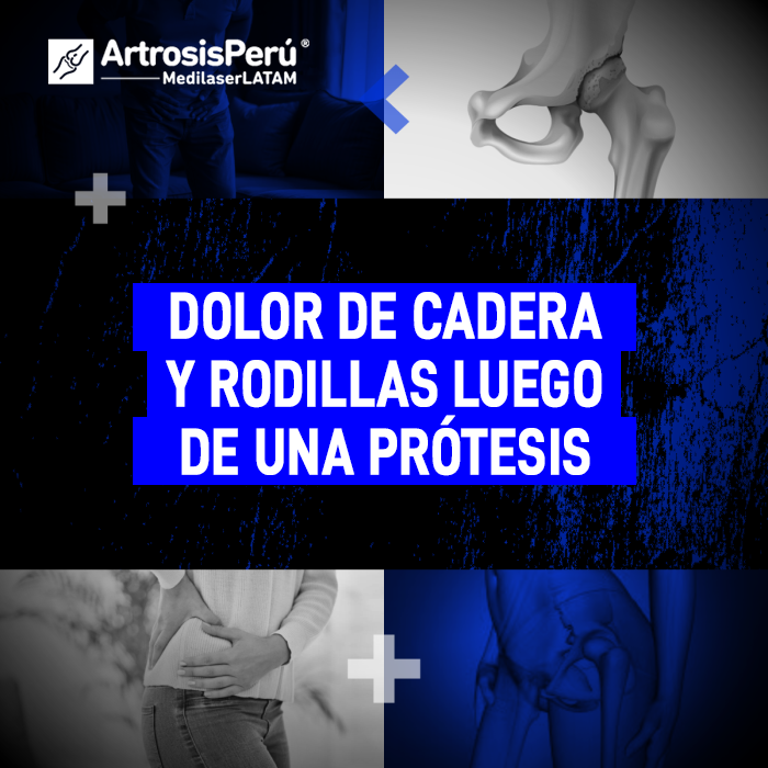 ¿Molestias persistentes tras una prótesis de cadera o rodilla? Descubre técnicas no invasivas para aliviar el dolor inflamatorio.