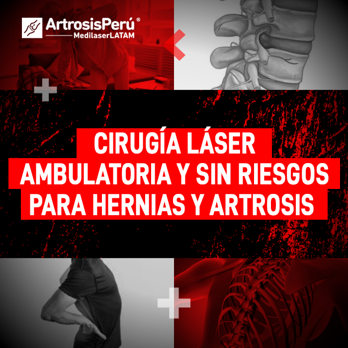 Cirugía láser ambulatoria para tratar hernias y artrosis sin cortes. Infórmate sobre este procedimiento médico seguro en Medilaser LATAM.