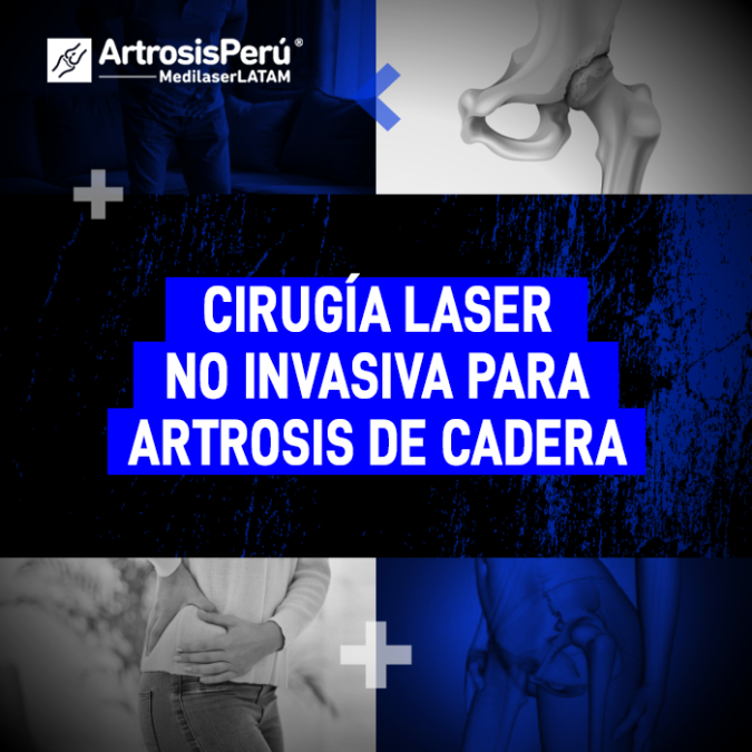 Cirugía láser no invasiva para Artrosis de cadera. Descubre cómo esta tecnología médica ayuda a recuperar la movilidad y reducir el dolor.