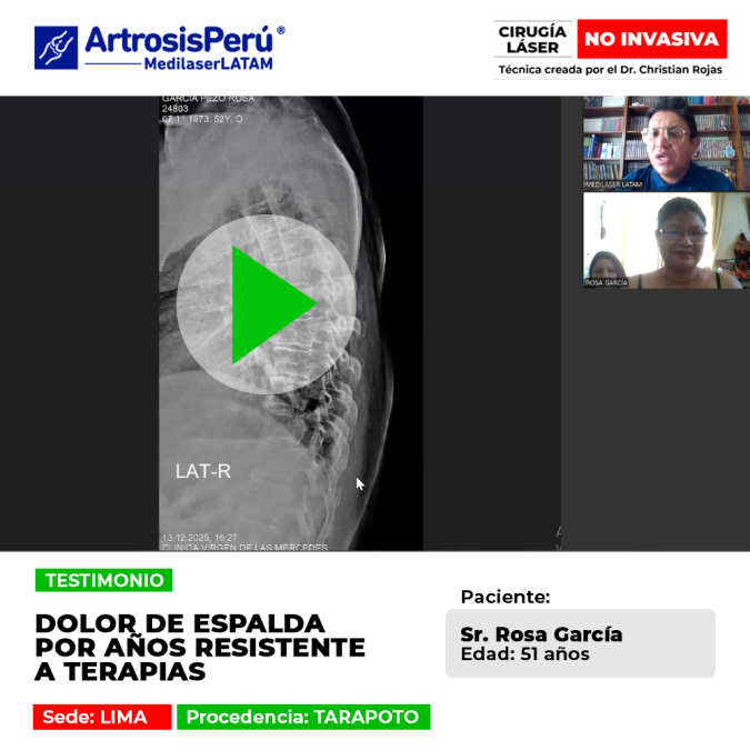 Dolor de espalda por años resistente a terapias. Descubre la recuperación de este paciente con tecnología láser avanzada en nuestro blog.