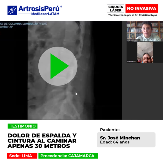 Dolor de espalda crónico que limita tu marcha. Conoce este caso clínico resuelto mediante tratamiento láser ambulatorio en Medilaser LATAM.