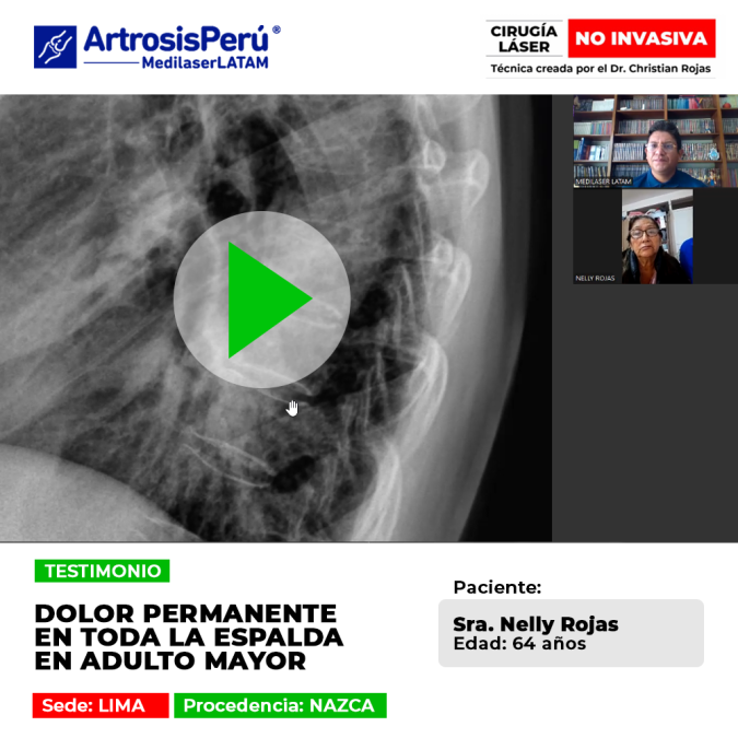 Dolor permanente en la columna vertebral. Aprende por qué nuestra tecnología es la mejor opción para regenerar discos dañados sin riesgos.
