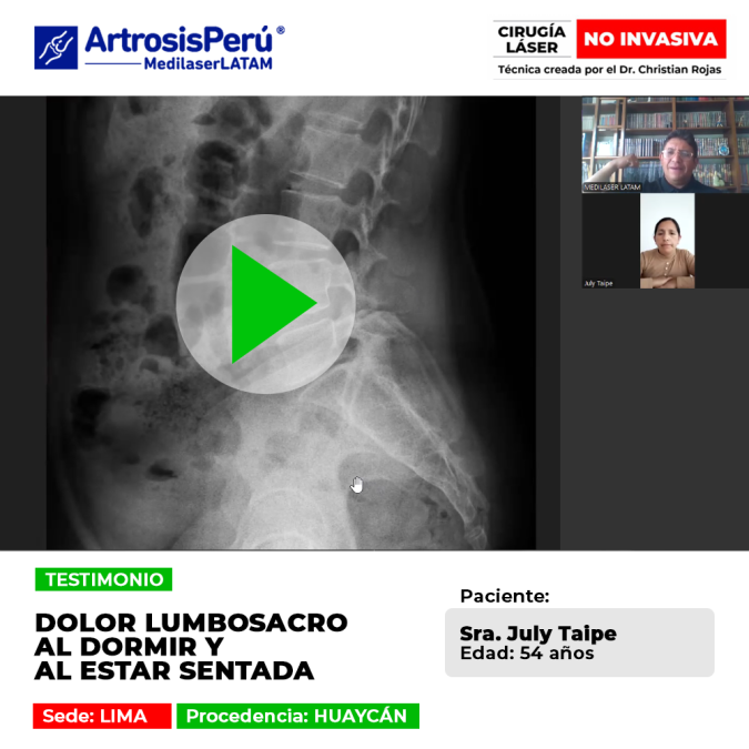 ¿Sufres de dolor lumbosacro al descansar? Mira cómo este tratamiento láser especializado devuelve el bienestar y la movilidad en Medilaser LATAM.