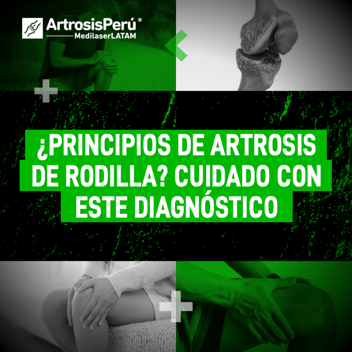 ¿Te diagnosticaron inicios de desgaste articular? Conoce la importancia de una evaluación precisa para proteger la salud de tus rodillas.