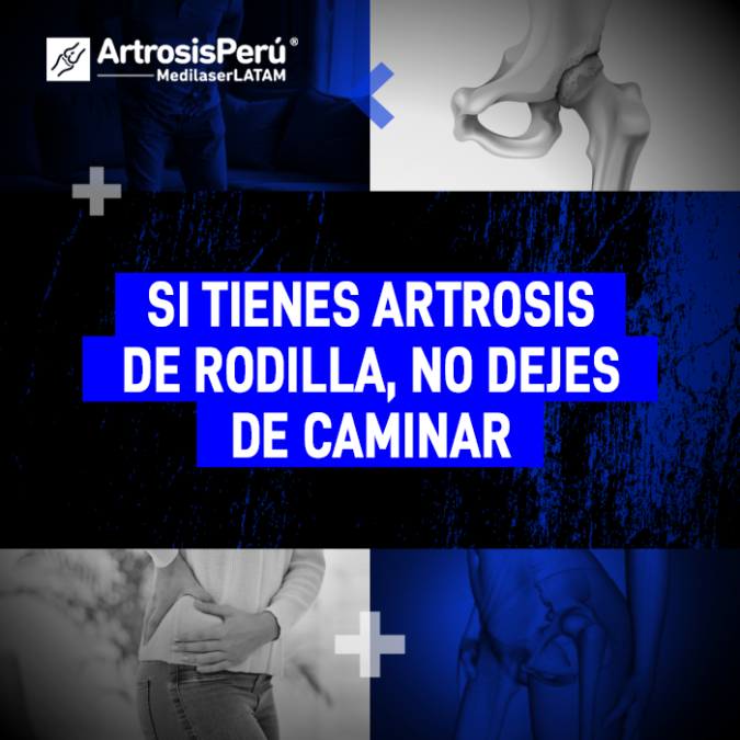 Mantener la movilidad es clave. Descubre por qué caminar ayuda a tu recuperación y cómo fortalecer tus rodillas con artrosis.