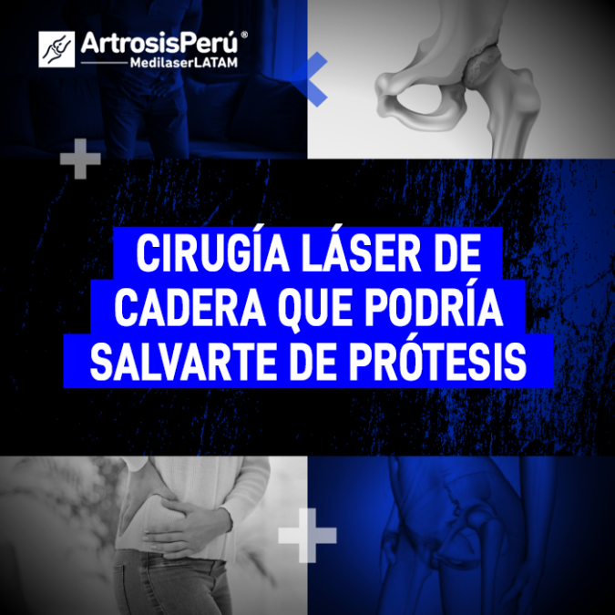 Descubre cómo la tecnología médica avanzada permite tratar el desgaste de cadera a tiempo, evitando intervenciones quirúrgicas mayores.