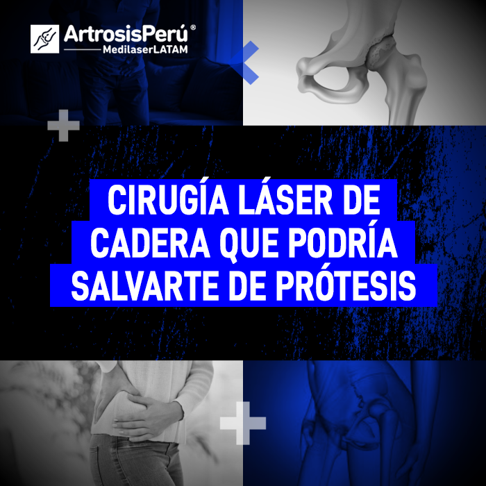 Descubre cómo la tecnología médica avanzada permite tratar el desgaste de cadera a tiempo, evitando intervenciones quirúrgicas mayores.