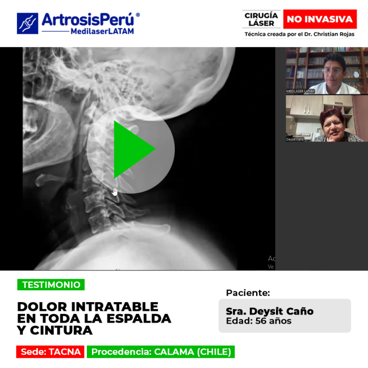 Pon fin al dolor lumbar severo que afecta tu espalda y cintura. Tratamientos láser efectivos para recuperar tu movilidad rápidamente.