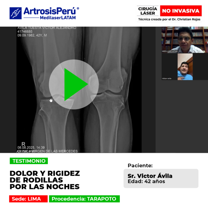 ¿Sufres de rodillas rígidas e inflamadas al descansar? Conoce el tratamiento láser efectivo para aliviar el dolor nocturno.