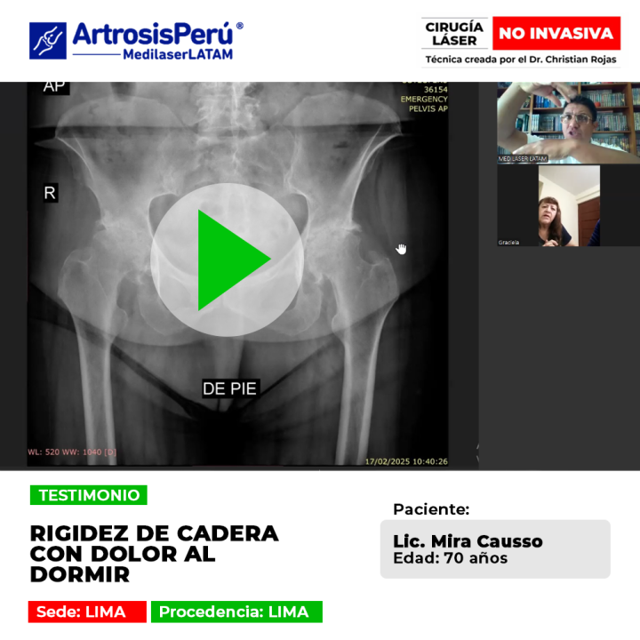 ¿El dolor de cadera no te deja descansar por las noches? Descubre la alternativa tecnológica para aliviar la rigidez articular hoy.