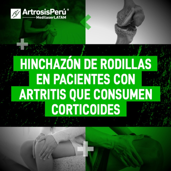 Descubre la relación entre el uso de corticoides y la persistencia de la inflamación articular en personas con diagnóstico de artritis.
