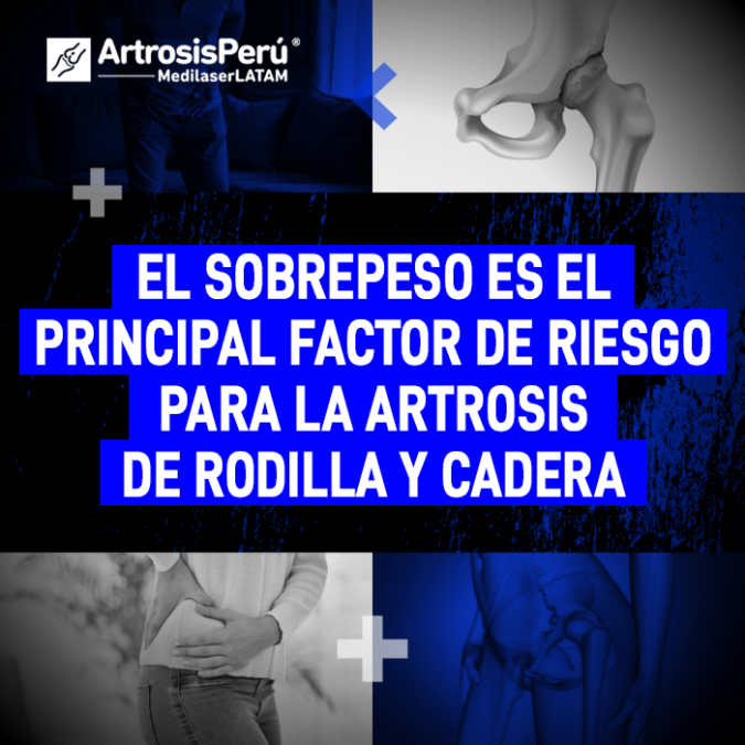 Entiende cómo el exceso de peso acelera el desgaste articular en tren inferior y las medidas tecnológicas para frenar este daño.