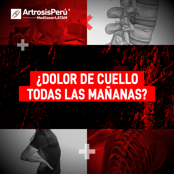 Si despiertas con rigidez y molestias cervicales constantes, infórmate sobre las causas mecánicas y cómo frenar el desgaste en el cuello.