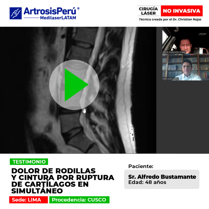 Conoce la historia de superación de un paciente con desgaste severo y simultáneo de cartílagos en rodillas y zona lumbar.