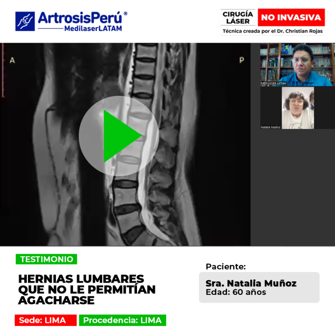 Conoce la historia de una paciente que recuperó la movilidad y la flexibilidad tras sufrir de severas hernias en la zona lumbar.